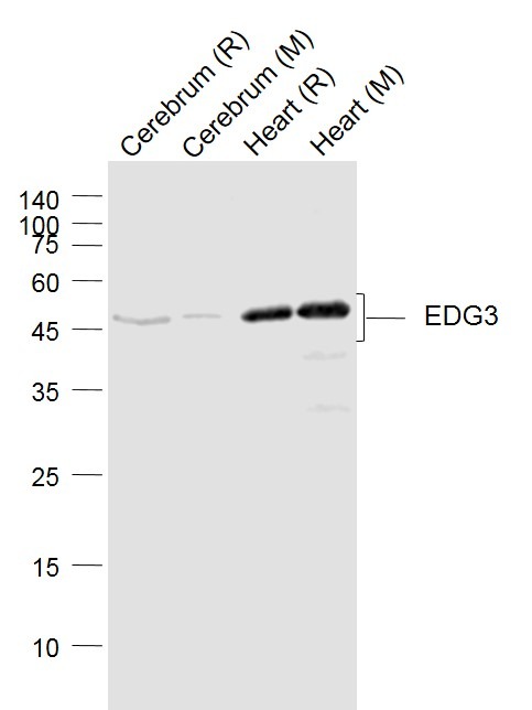 Anti-EDG3 Polyclonal Antibody