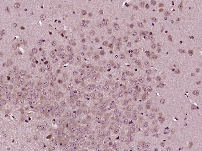 Anti-EDG1 Polyclonal Antibody