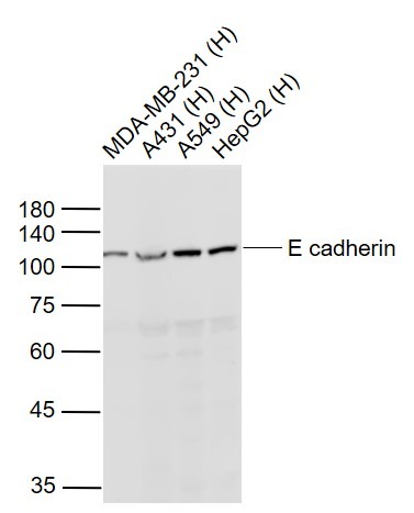 Anti-E-Cadherin/Cadherin-1 Polyclonal Antibody 3