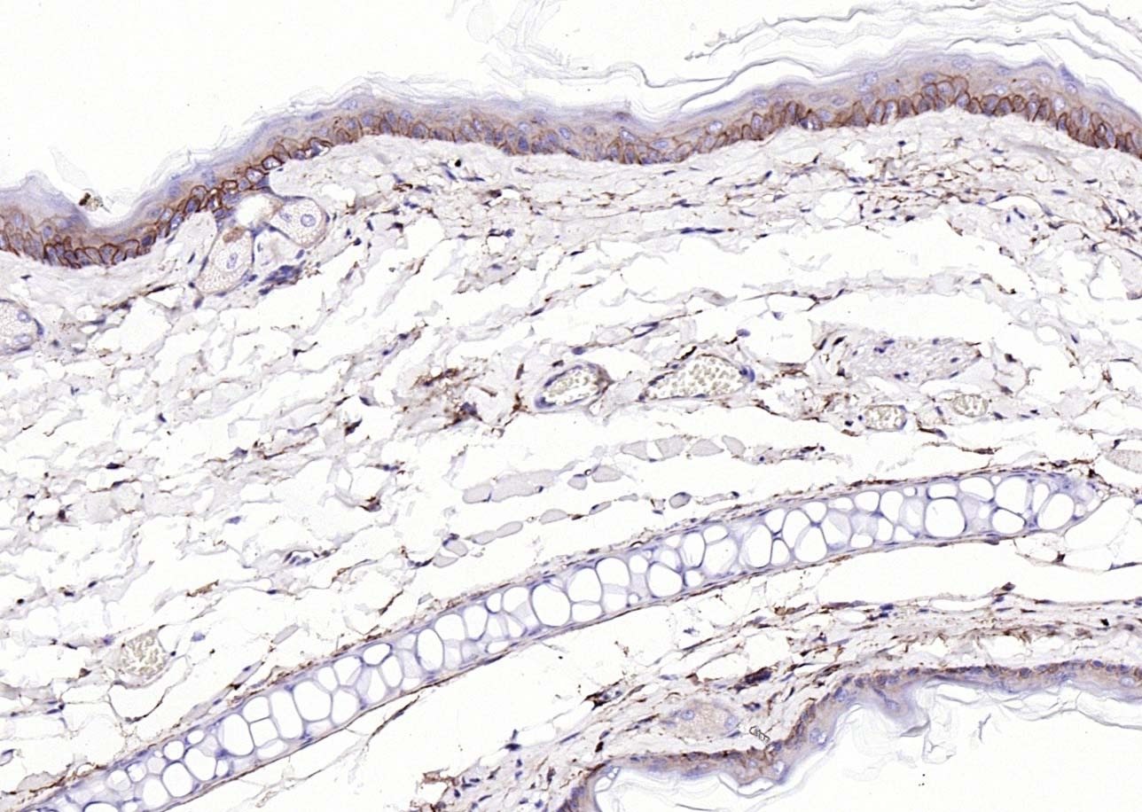 Anti-EGFR Polyclonal Antibody 3