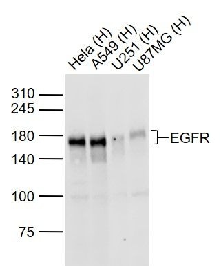 Anti-EGFR Polyclonal Antibody