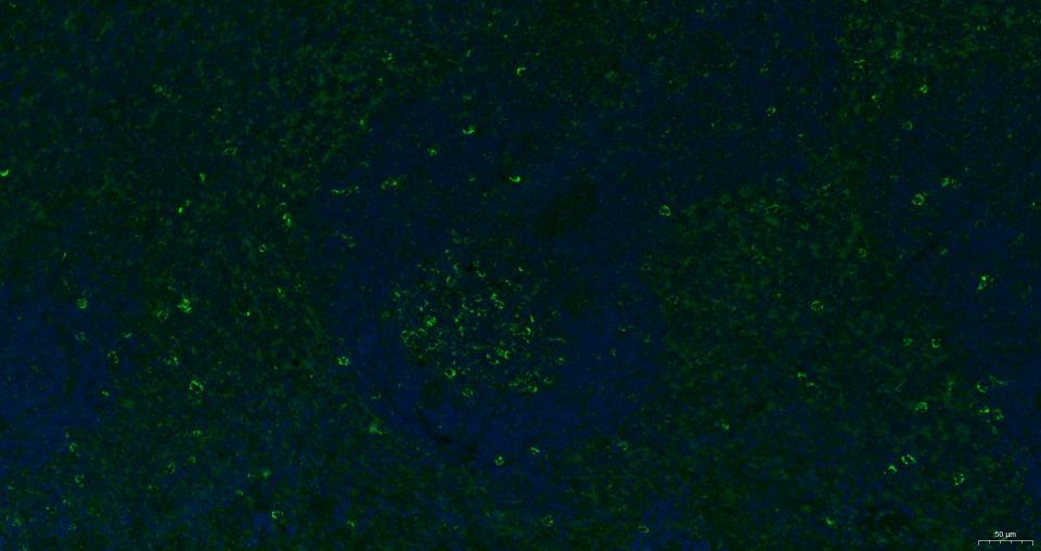 Anti-CXCR4 Polyclonal Antibody