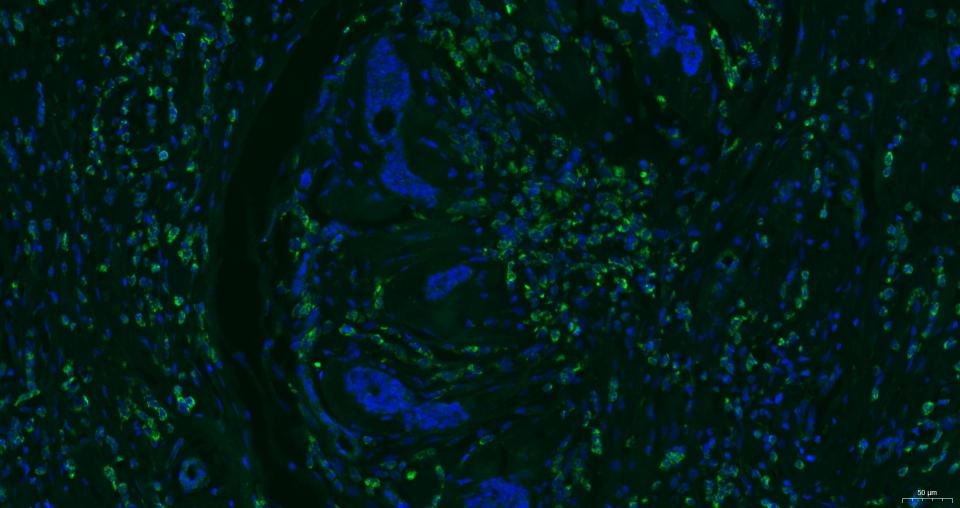 Anti-CXCR4 Polyclonal Antibody