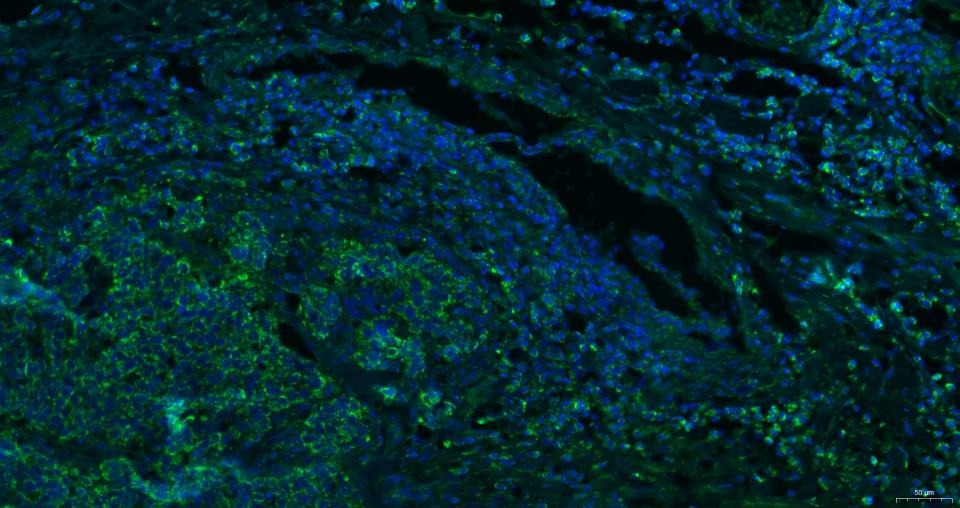 Anti-CXCR4 Polyclonal Antibody