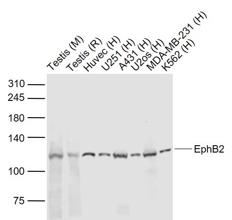 Anti-EphB2 Polyclonal Antibody