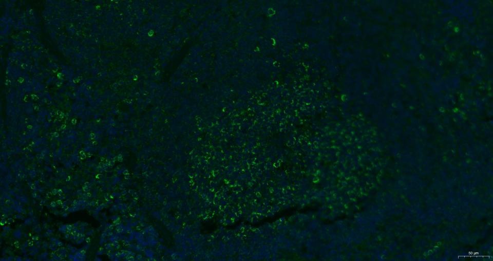 Anti-CXCR4 Polyclonal Antibody