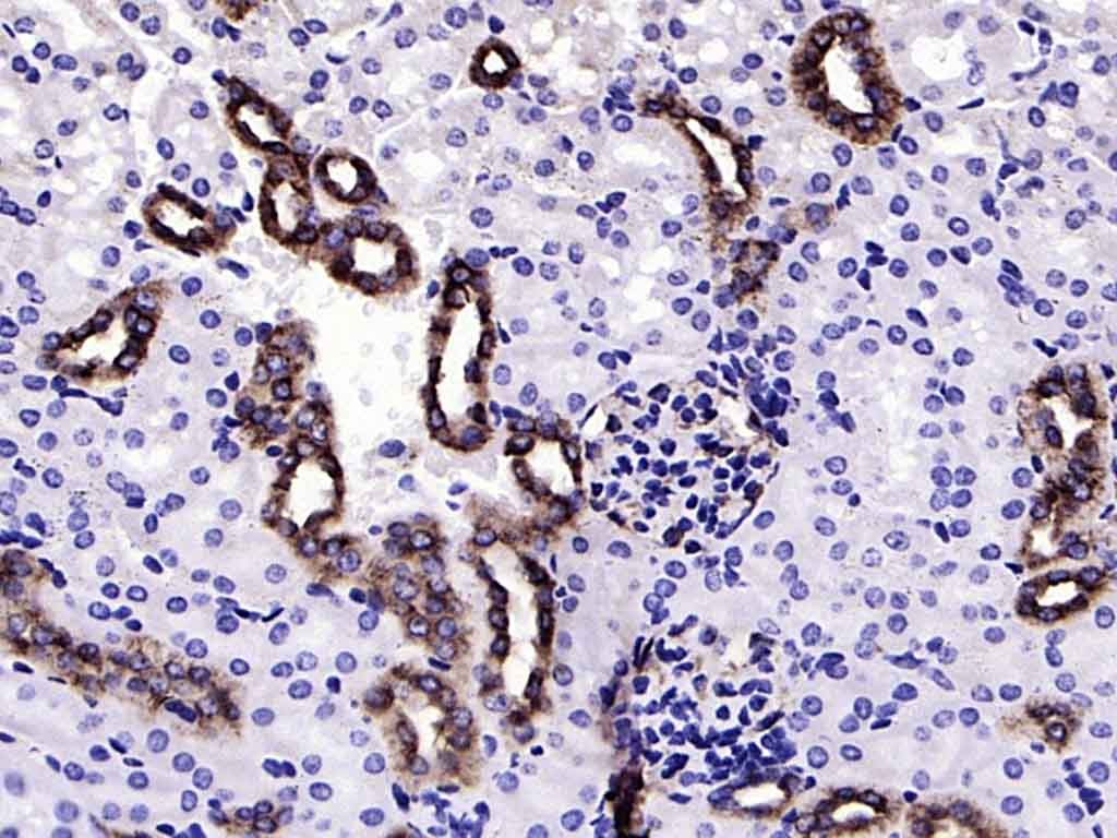 Anti-Ephrin B2/EFNB2 Antibody (6Q379)