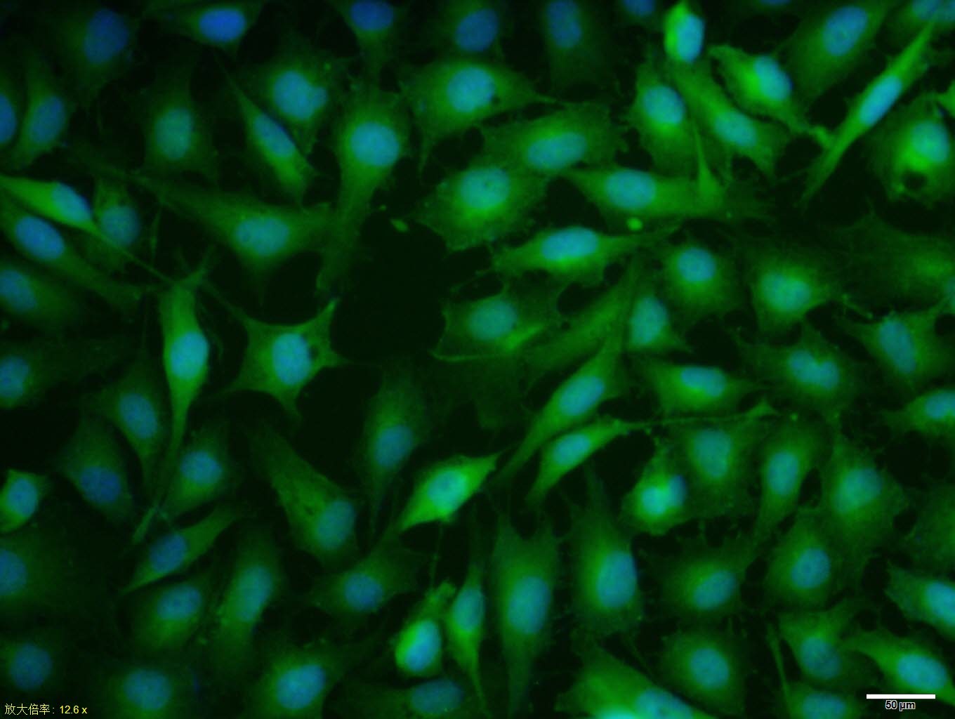 Anti-ER alpha Polyclonal Antibody 2