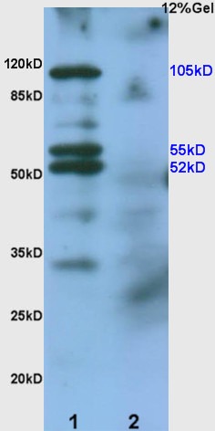 Anti-EphA2 Polyclonal Antibody
