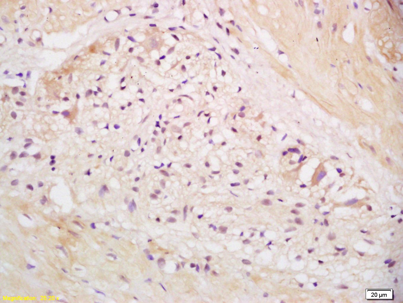 Anti-EEA1 Polyclonal Antibody