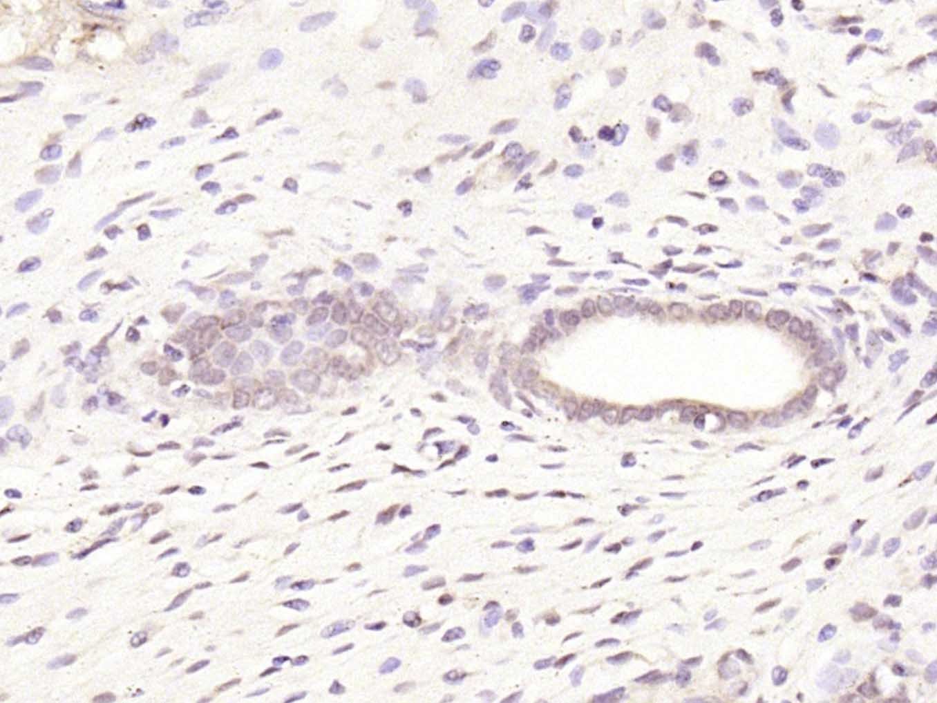 Anti-ER alpha Polyclonal Antibody