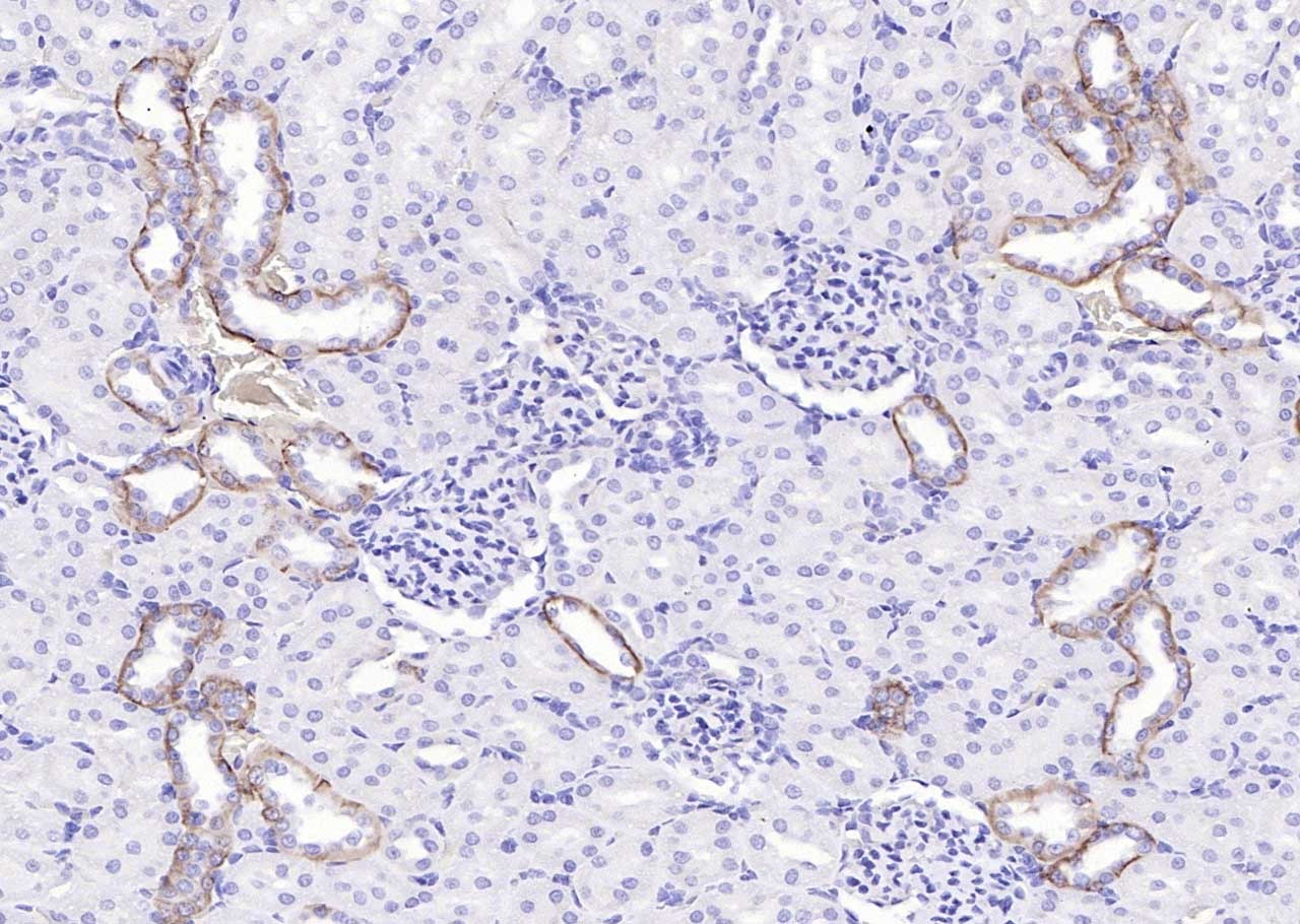 Anti-EGFR Polyclonal Antibody 3