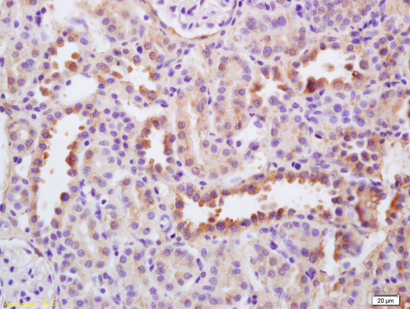 Anti-EGF Polyclonal Antibody 2
