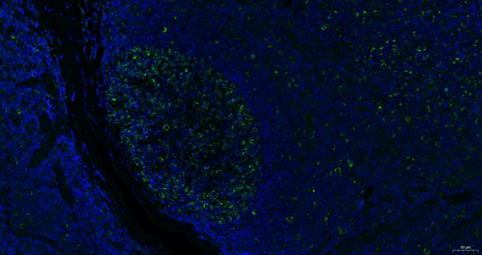 Anti-CXCR4 Polyclonal Antibody 2