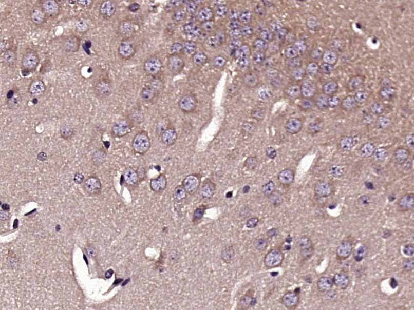Anti-Doublecortin/DCX Polyclonal Antibody 2