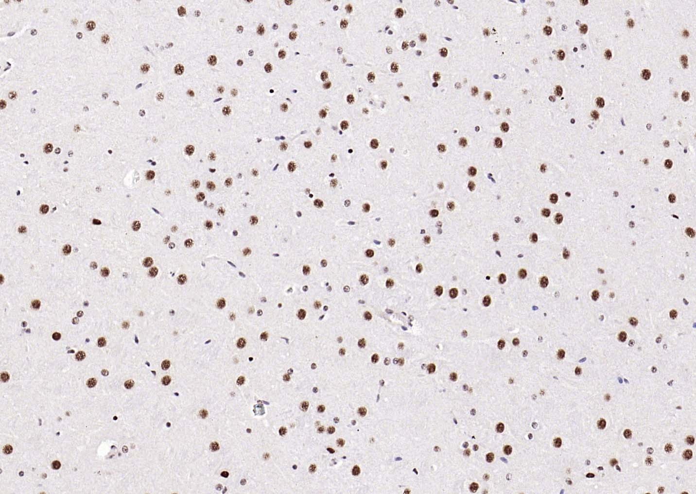 Anti-ER beta Polyclonal Antibody