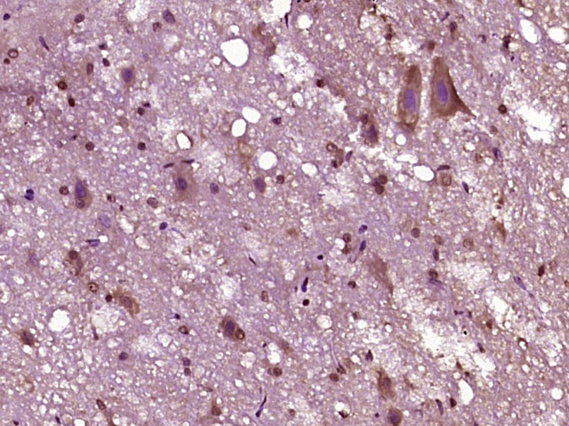 Anti-DNase I Polyclonal Antibody