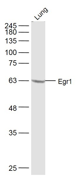 Anti-EGR1 Polyclonal Antibody