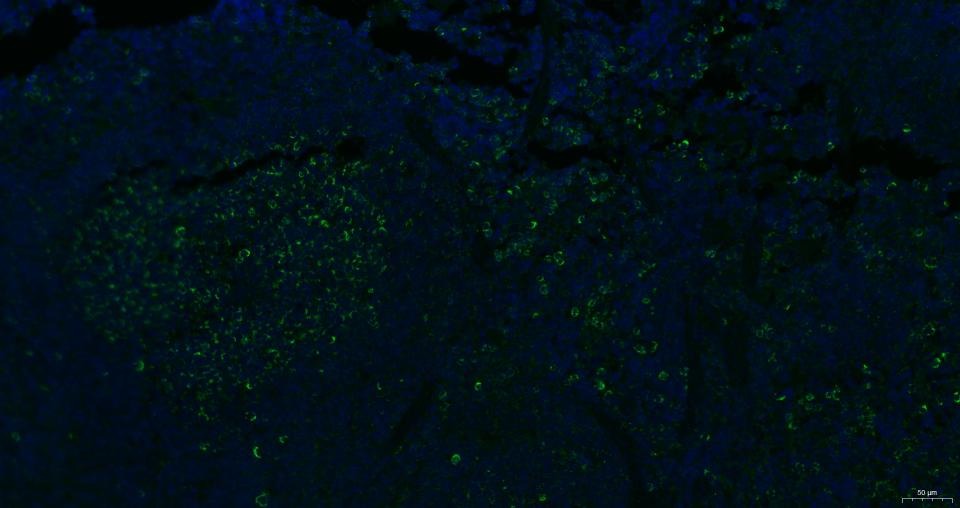 Anti-CXCR4 Polyclonal Antibody 2
