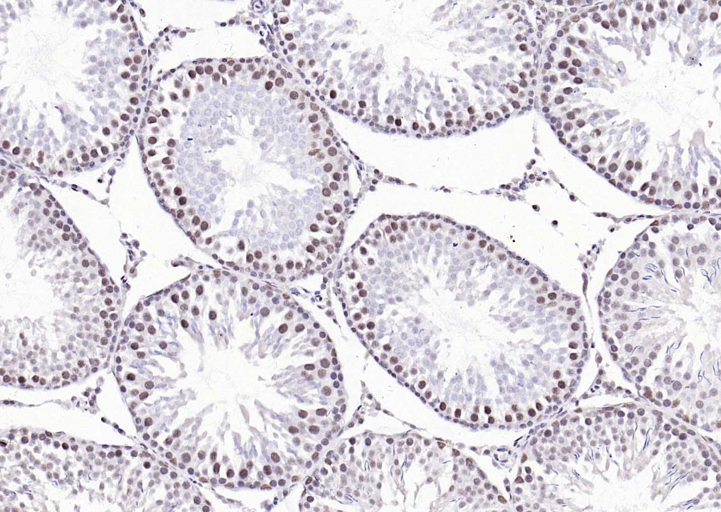 Anti-ER beta Polyclonal Antibody