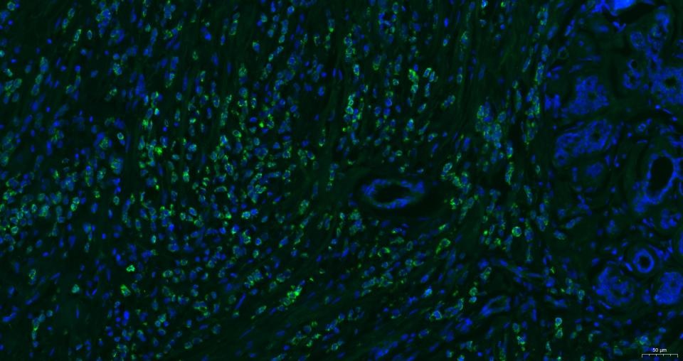 Anti-CXCR4 Polyclonal Antibody 2