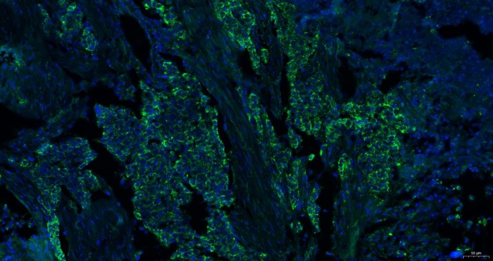 Anti-CXCR4 Polyclonal Antibody 2