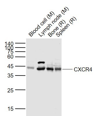 Anti-CXCR4 Polyclonal Antibody 2