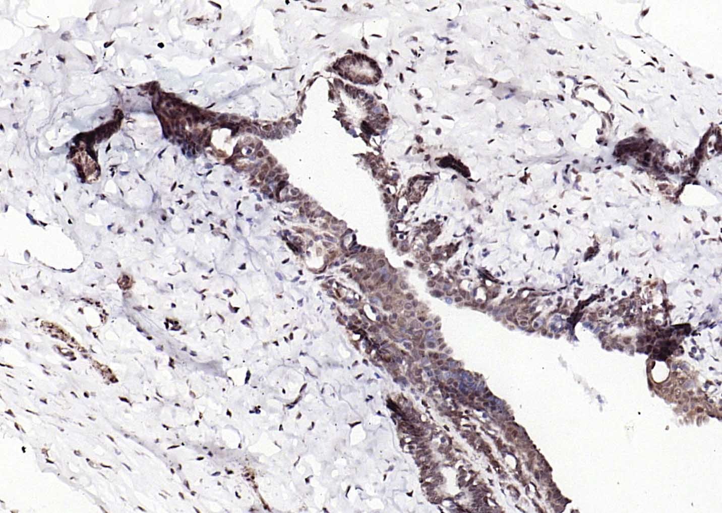 Anti-ER beta Polyclonal Antibody