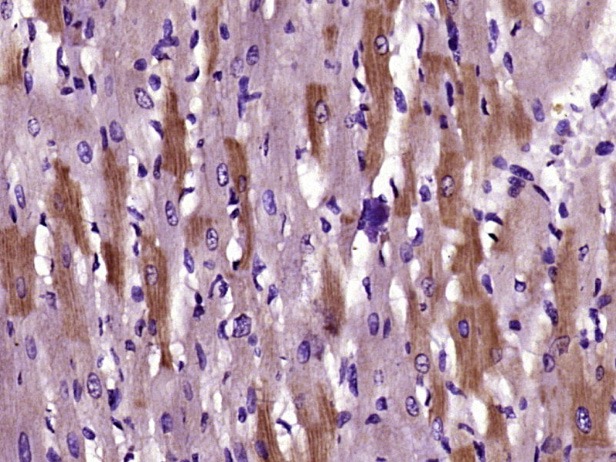Anti-DMT1 Polyclonal Antibody