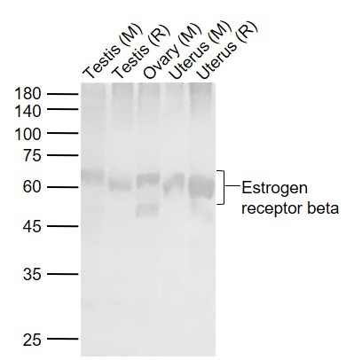 Anti-ER beta Polyclonal Antibody