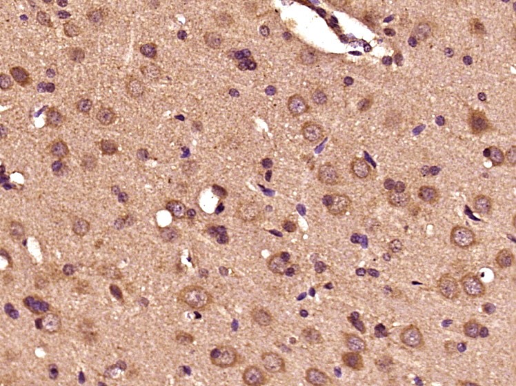 Anti-Dopamine beta-Hydroxylase Polyclonal Antibody
