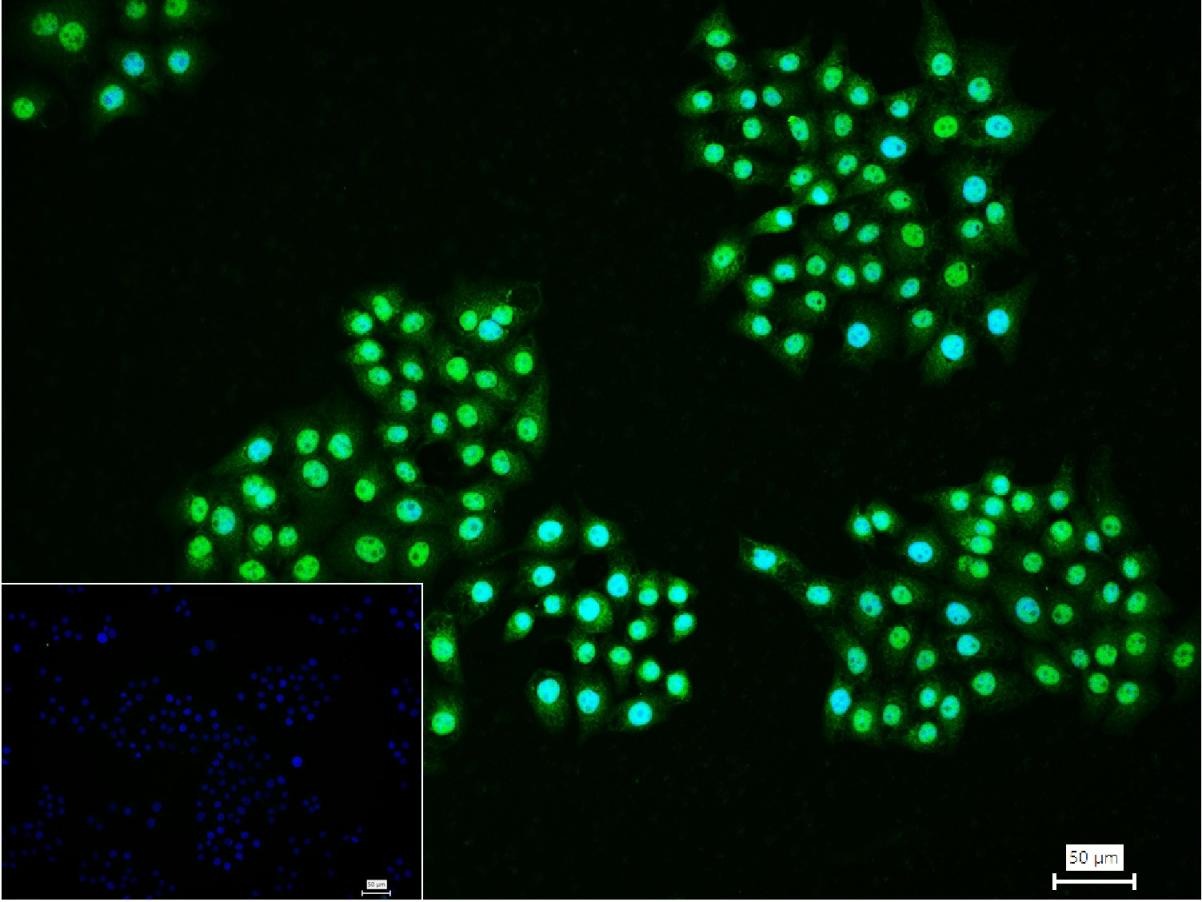 Anti-ER beta Polyclonal Antibody
