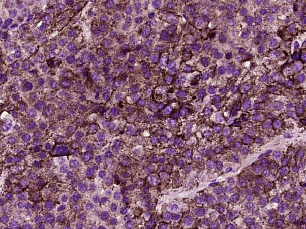 Anti-DPP4/CD26 Polyclonal Antibody