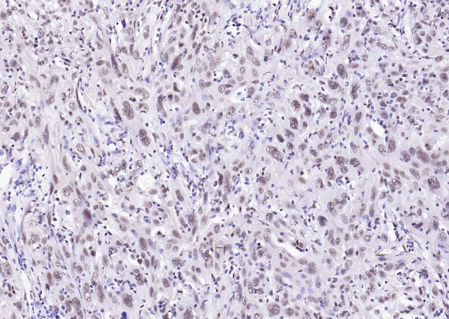 Anti-ER beta Polyclonal Antibody
