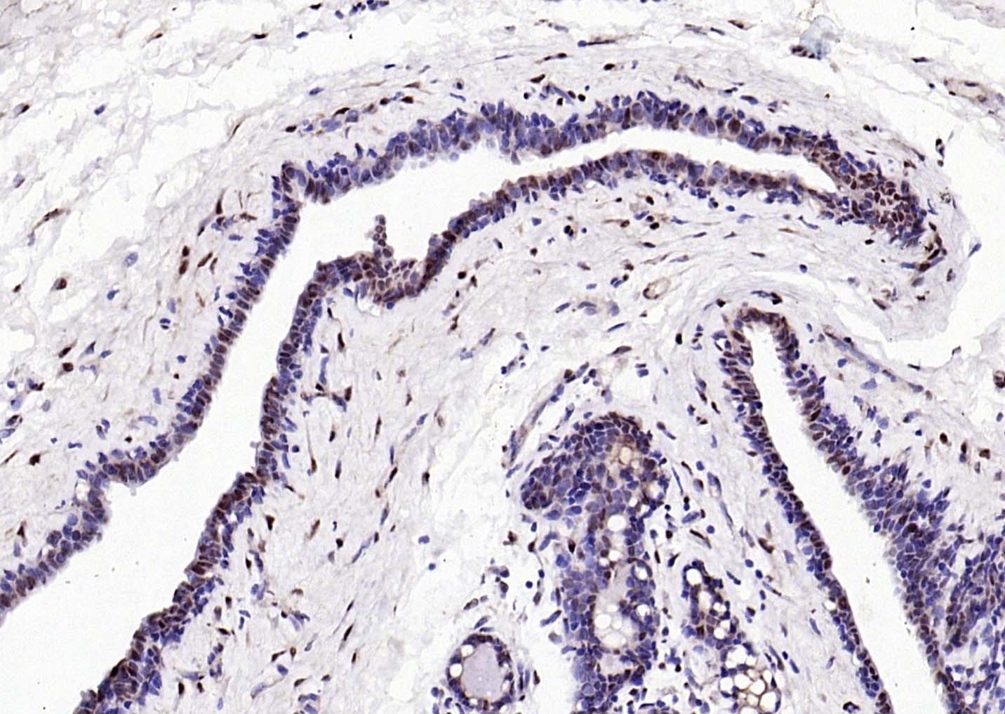 Anti-ER beta Polyclonal Antibody
