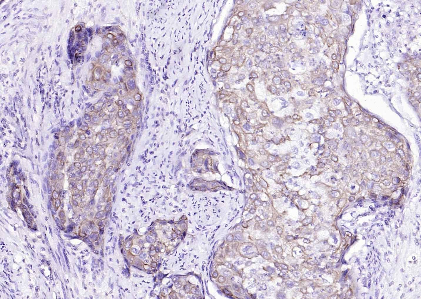 Anti-Cytokeratin 8 Antibody (5G219)
