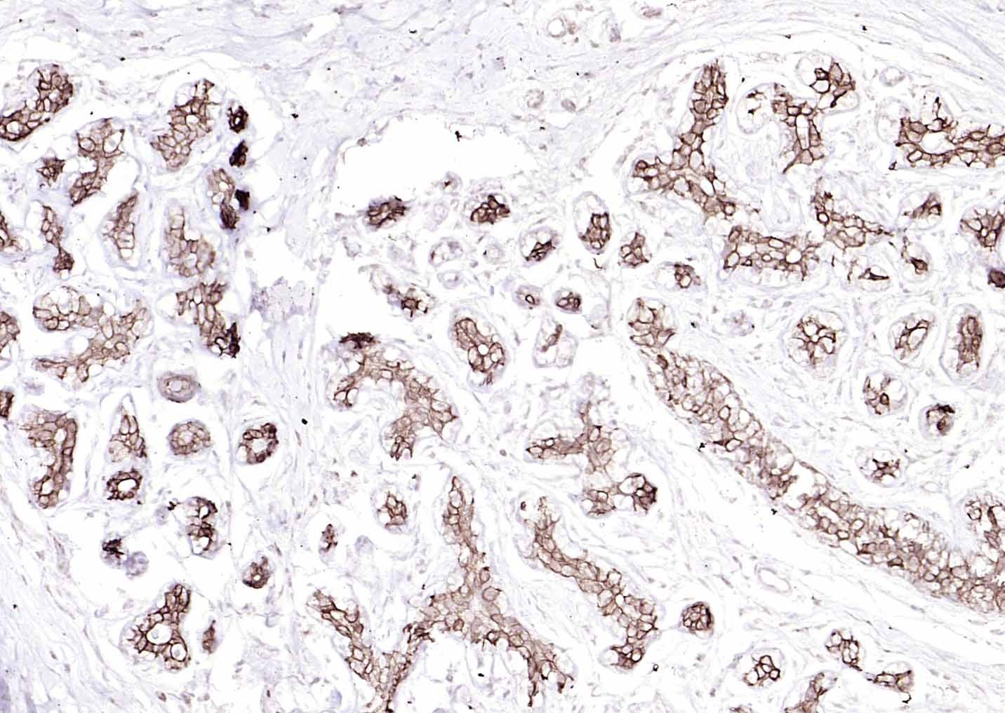 Anti-Cytokeratin 8 Antibody (5G219)