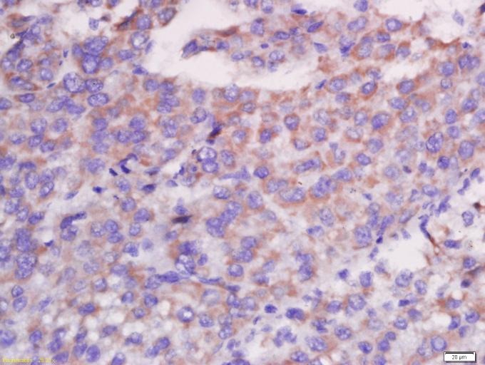 Anti-CXCL13/BCA-1 Polyclonal Antibody 2