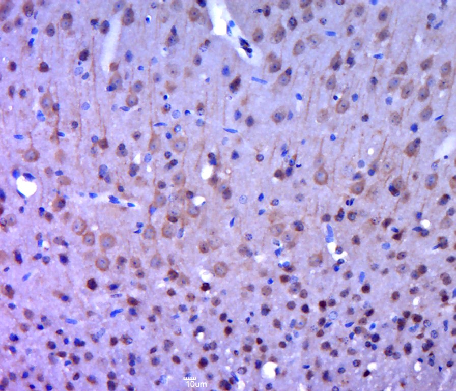 Anti-FAK Polyclonal Antibody 2