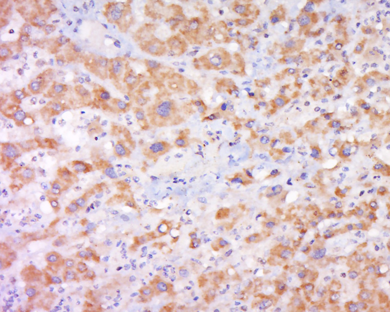 Anti-Cytochrome b245 Light Chain Polyclonal Antibody