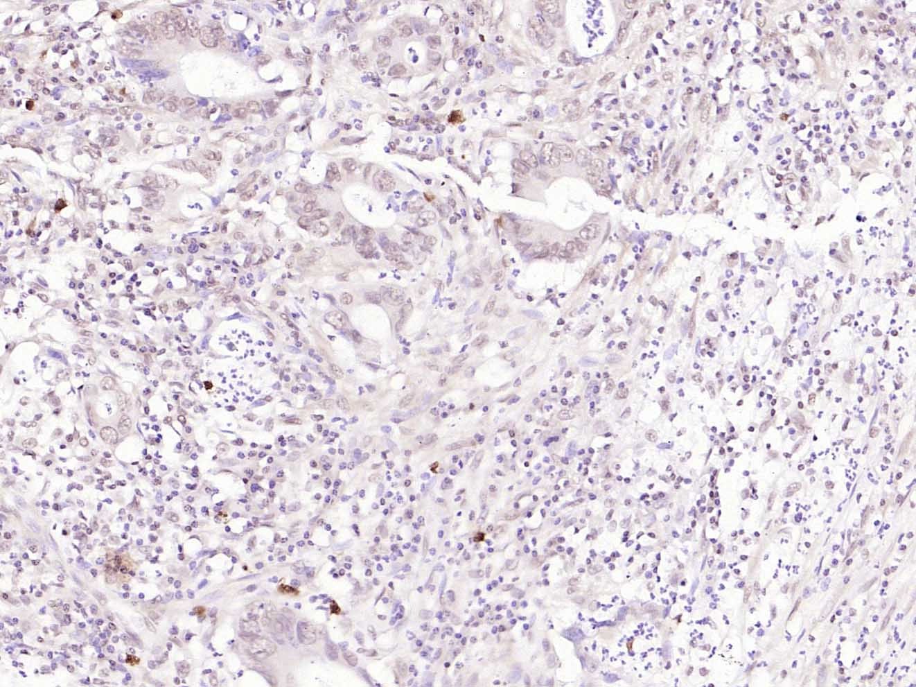 Anti-FAK Polyclonal Antibody
