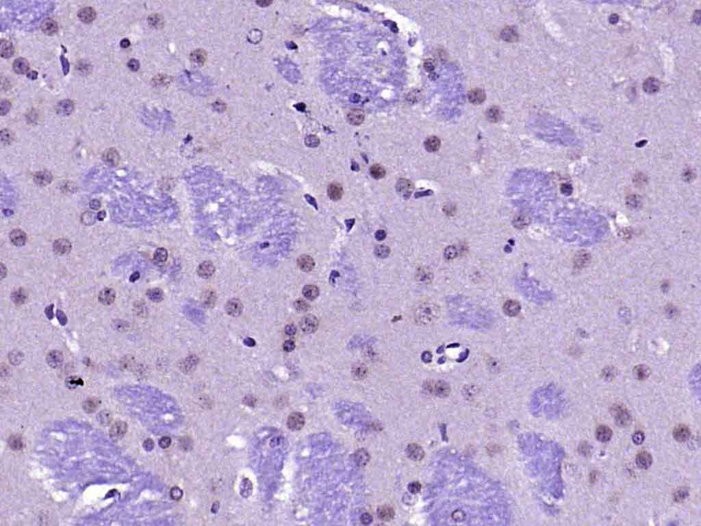 Anti-FAK Polyclonal Antibody 2
