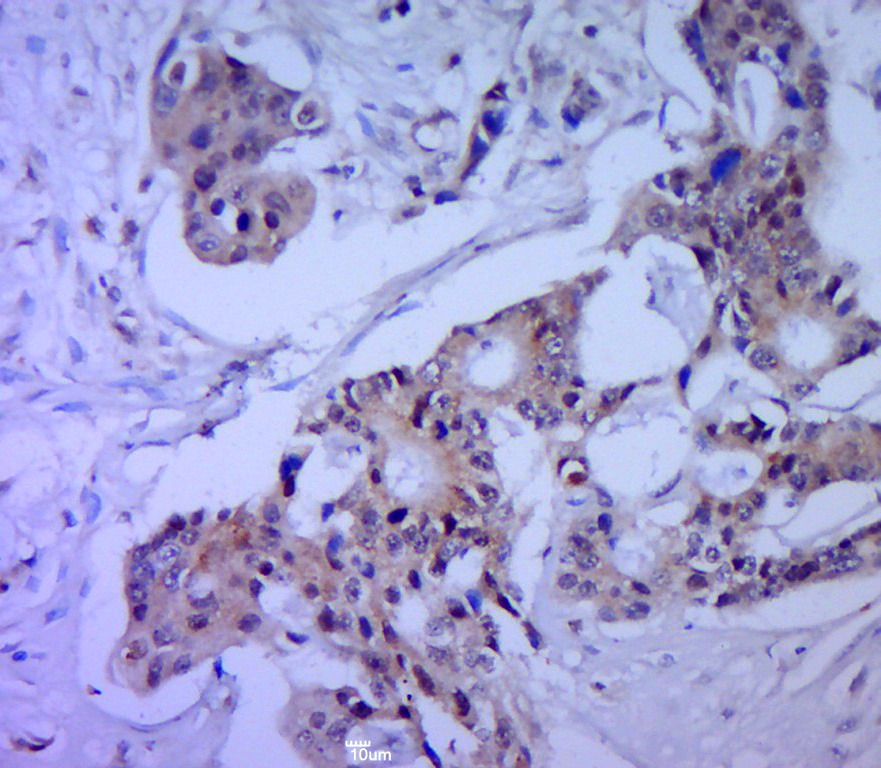 Anti-Cytokeratin 5 Polyclonal Antibody