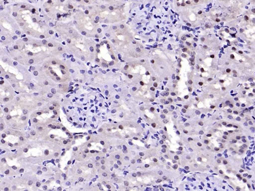 Anti-FAK Polyclonal Antibody 2