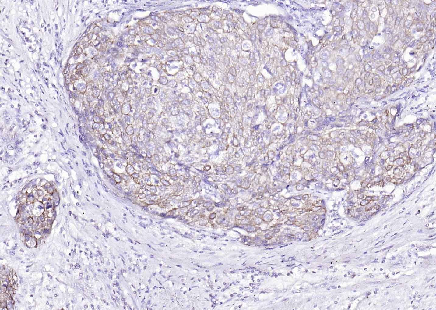 Anti-Cytokeratin 8 Antibody (5G219)