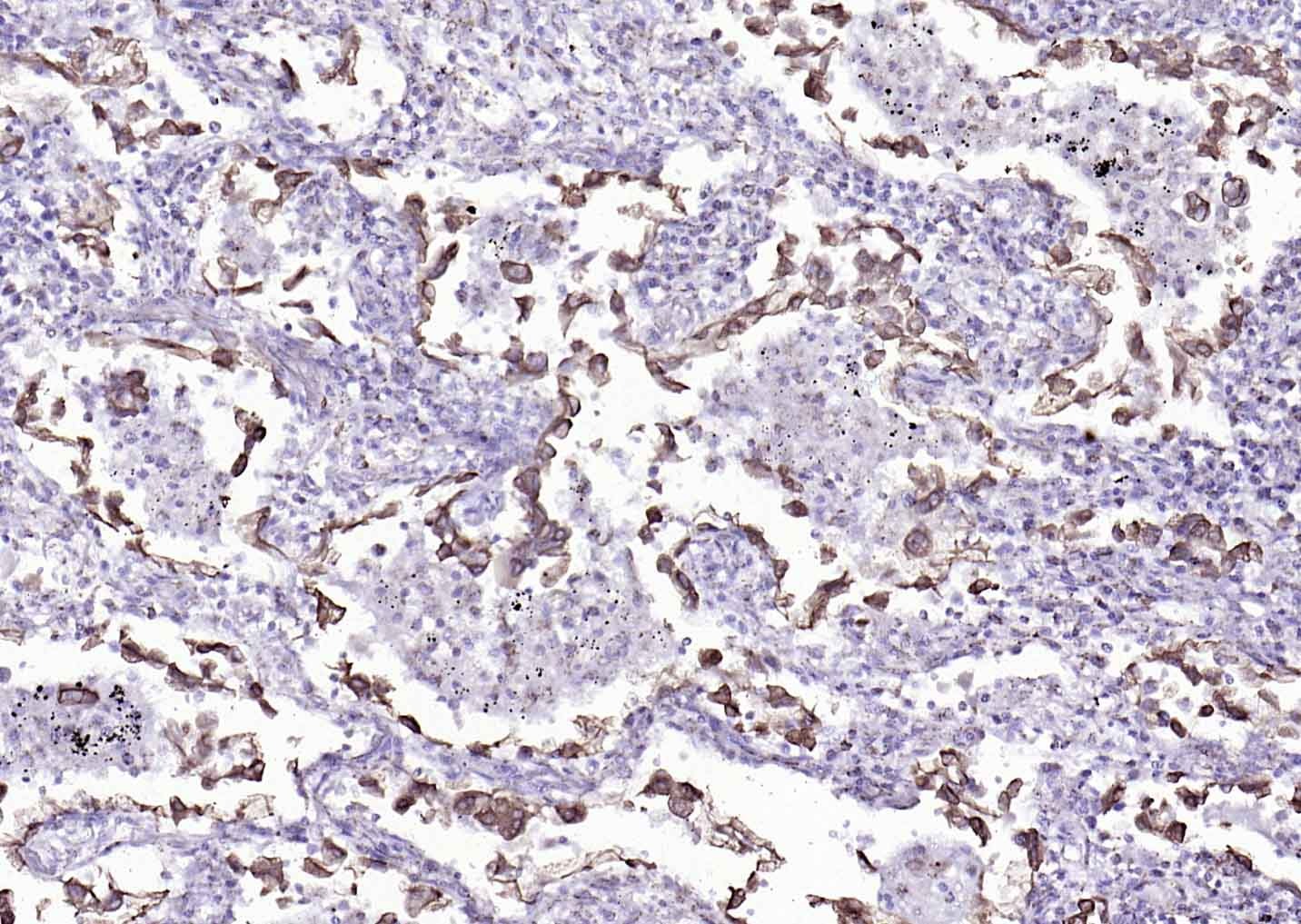 Anti-Cytokeratin 8 Antibody (5G219)