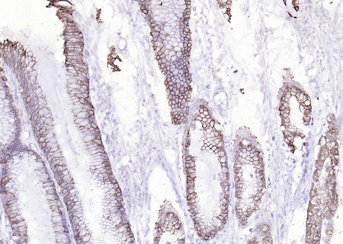 Anti-Cytokeratin 8 Antibody (5G219)