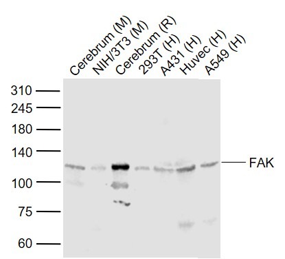 Anti-FAK Polyclonal Antibody