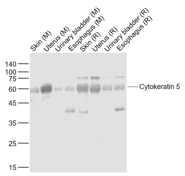 Anti-Cytokeratin 5 Polyclonal Antibody