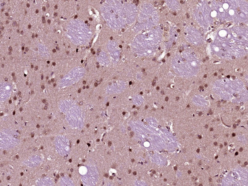 Anti-FAK Polyclonal Antibody 2